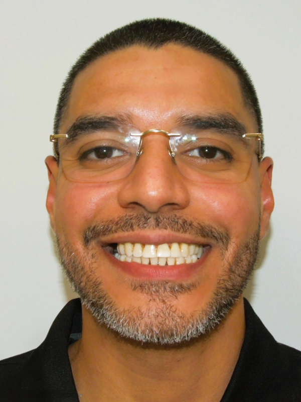 Confident adult patient showcasing a beautifully restored smile following comprehensive multidisciplinary orthodontic therapy in Miami.