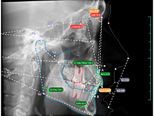 Miami orthodontist analyzing a cephalometric X-ray for precision braces and ClearCorrect treatment in Kendall.