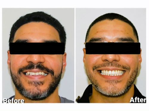 Restoring Confidence with Exceptional Care