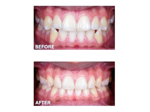 Specialized Miami Orthodontist: Stunning Braces & Personal Care